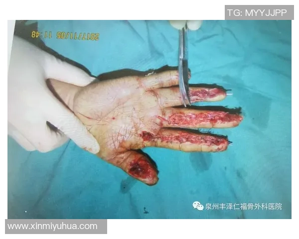 足球场上的咬人事件揭秘牙齿咬人的明星球员背后的故事